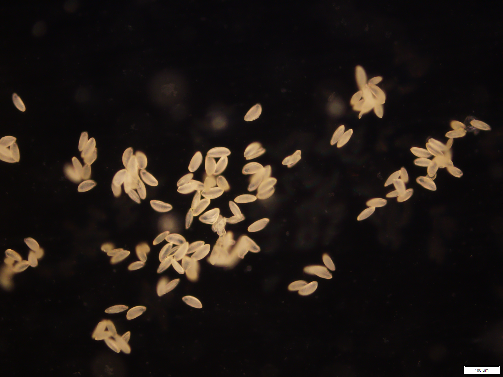 
          *Narcissus* pollen grains in whole mount. The pollen was observed dry using a compound microscope with reflected light darkfield illumination. Scale bar indicates 100 µm.
        